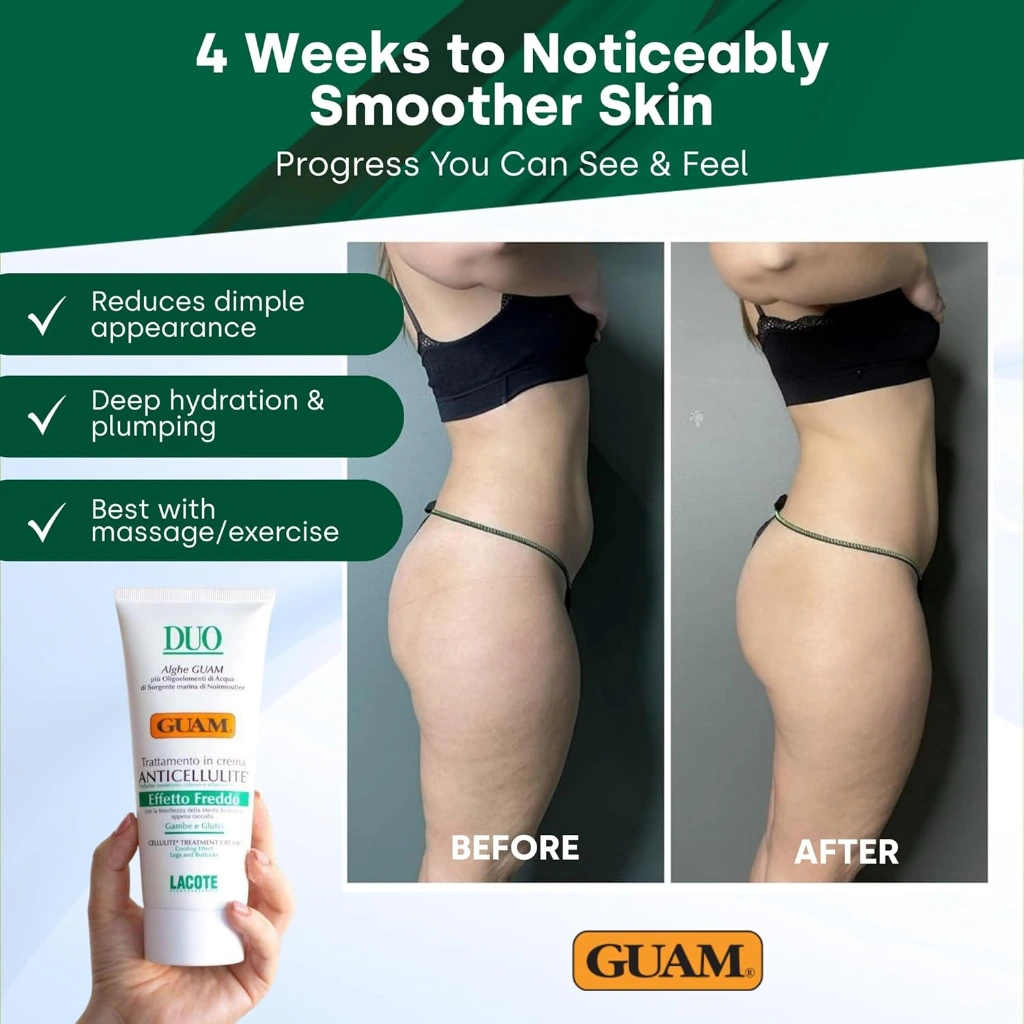 GUAM DUO Anti-Cellulite Creme kühlende Wirkung vorher nacher.webp